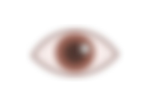 Understanding Blurred Vision: Causes, Symptoms, and Treatments