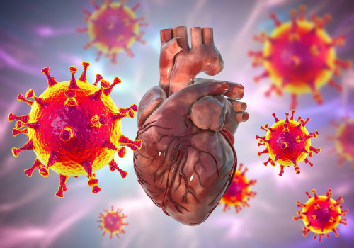 Cardiovascular Disease: Exploring Causes, Symptoms, and Treatment